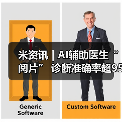 米资讯 | AI辅助医生“阅片” 诊断准确率超95% 米资讯 | AI辅助医生“阅片” 诊断准确率超95%